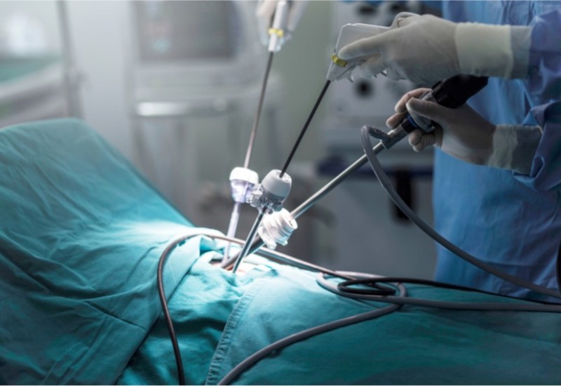 Gynae Laparoscopy