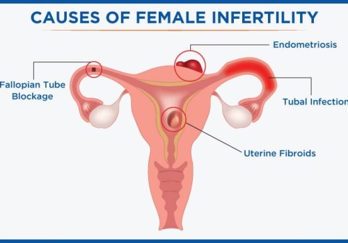 Infertility Management